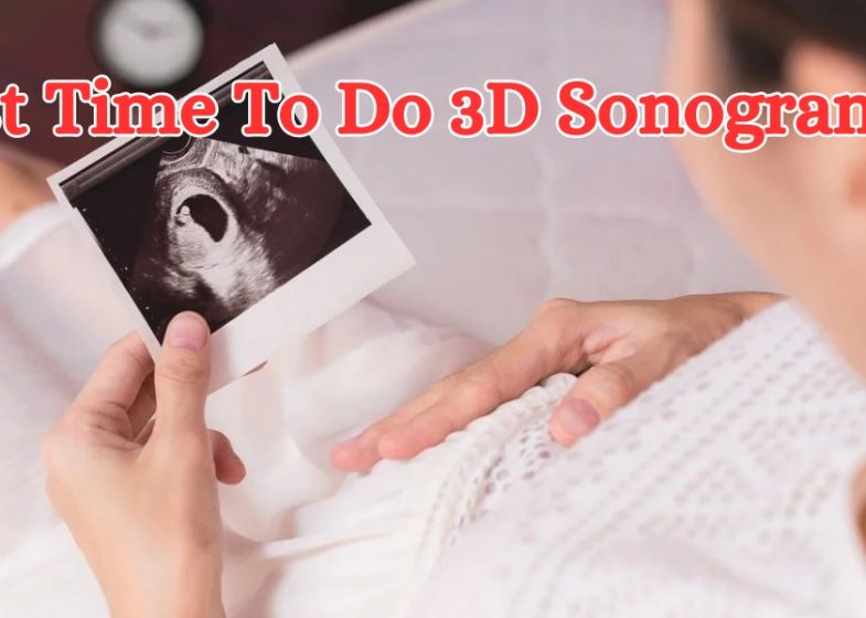 Best Time To Do 3D Sonogram