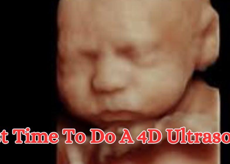 Best Time To Do A 4D Ultrasound