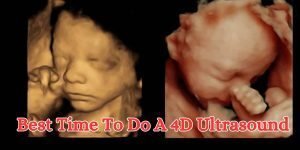 best-time-to-do-a-4d-ultrasound